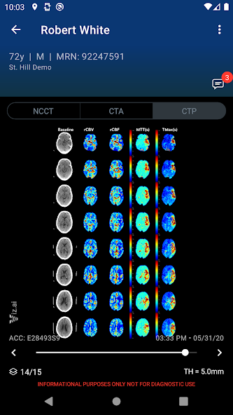 Viz.ai